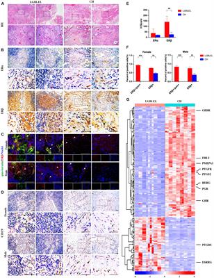 Missing link between tissue specific expressing pattern of ERβ and the clinical manifestations in LGBLEL